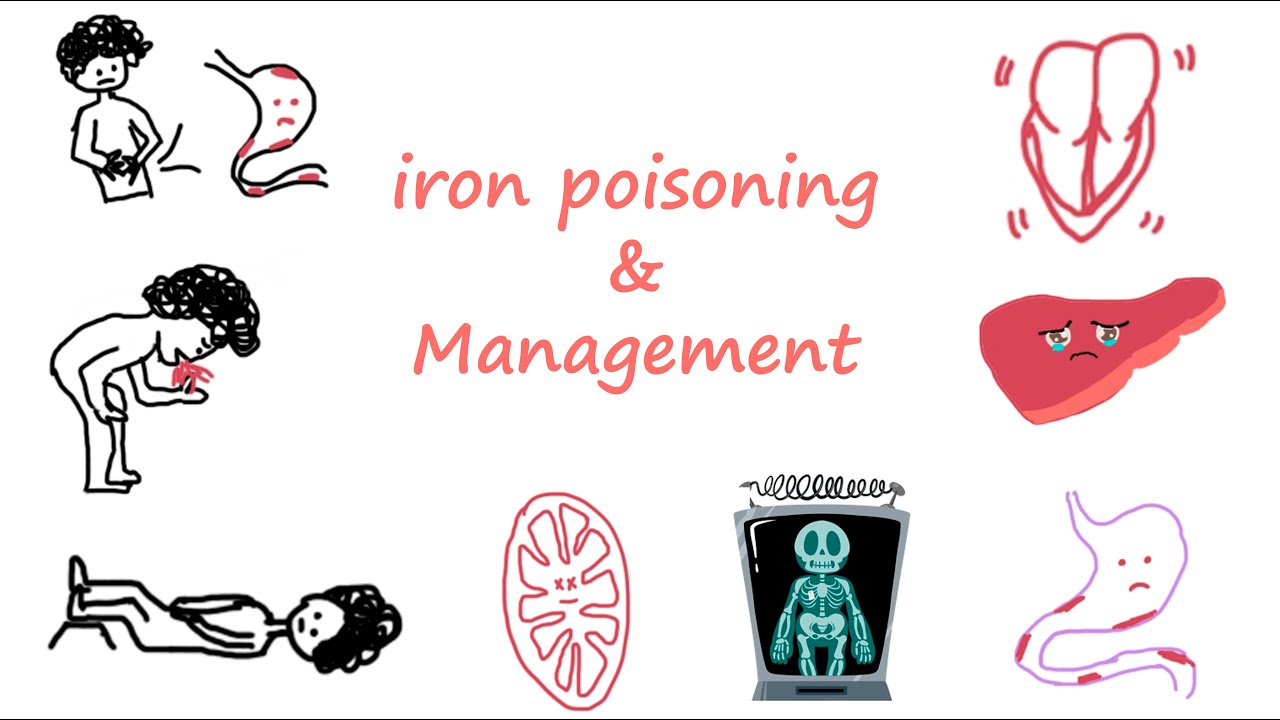 Lets discuss the Brief Idea on Iron Toxicity