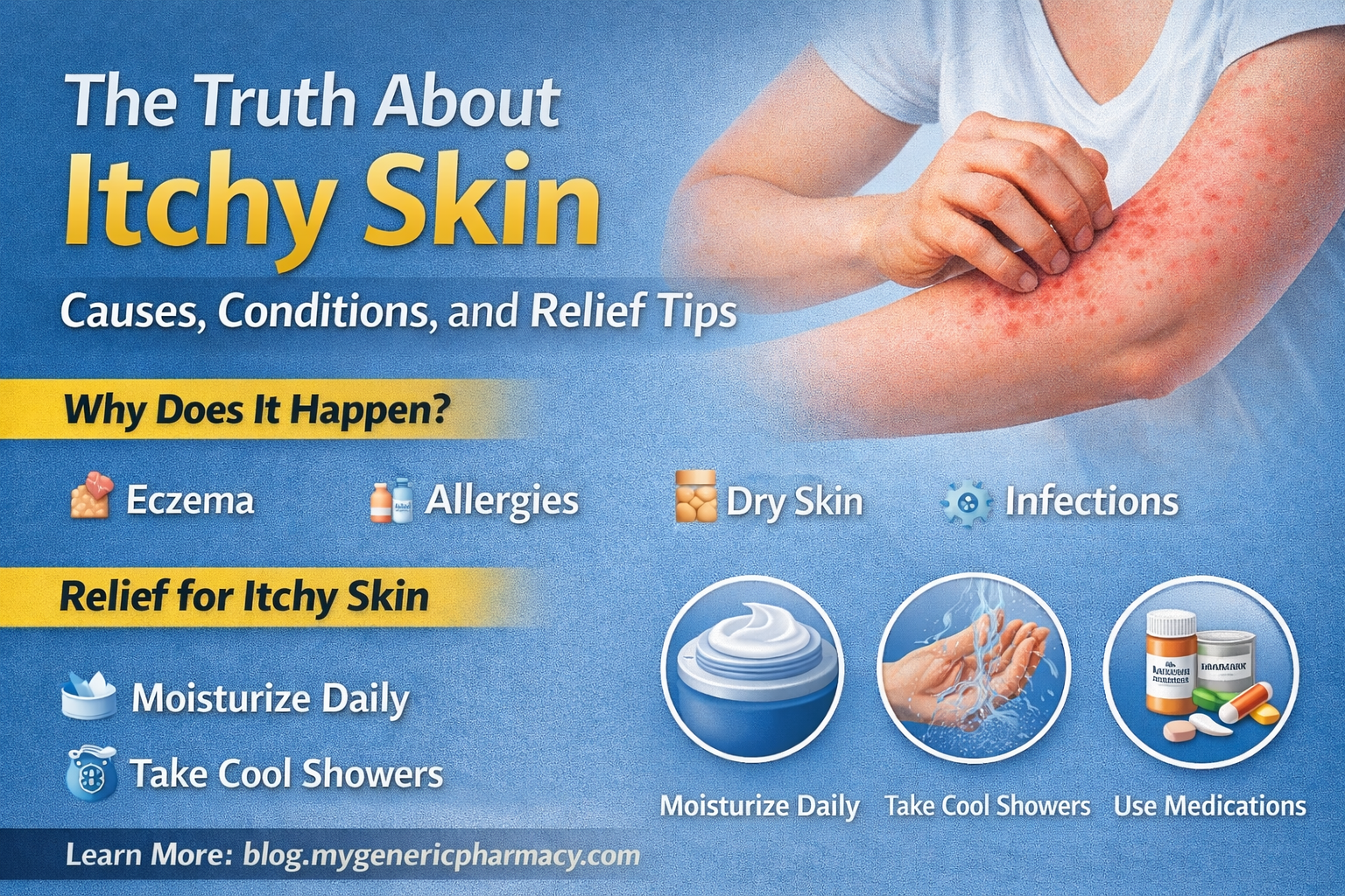 Eczema in Kids