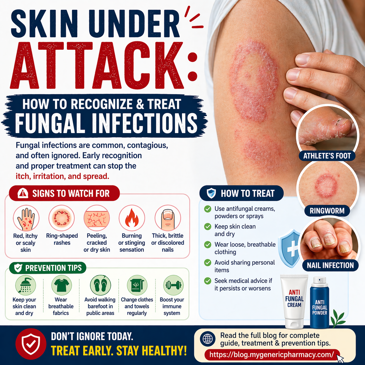 Fungal Infections